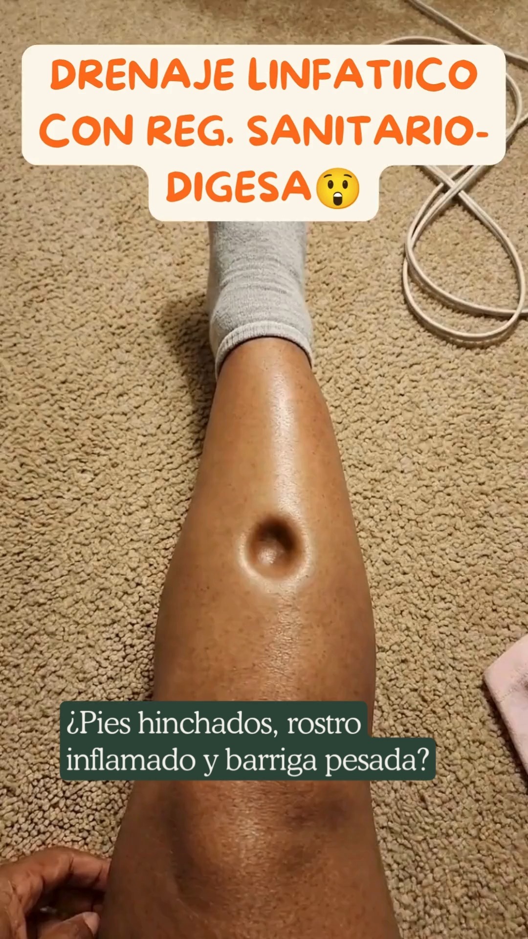 Drenaje linfático Aurelys gotas